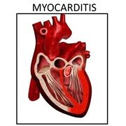 Myocarditis