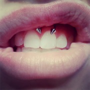 Smiley Piercing