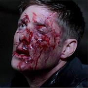 Dean Winchester (Supernatural)