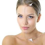 Microdermabrasion Facial