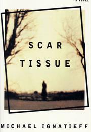 Michael Ignatieff: Scar Tissue