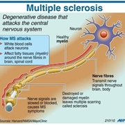 Multiple Sclerosis Day (May 25)