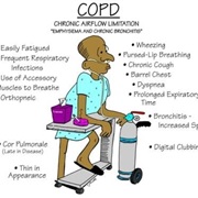 COPD