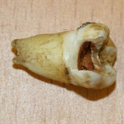 Had a Rotten Tooth