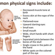 Down Syndrome Day (March 21)