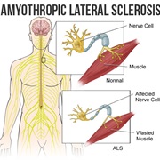 ALS