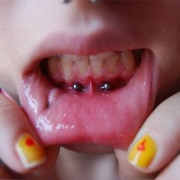 Anti Smiley Piercing