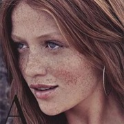 Freckles