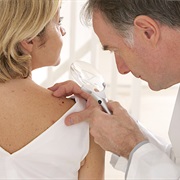 Skin Cancer Screening