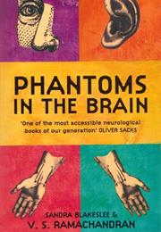 Phantoms in the Brain