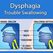 Dysphagia