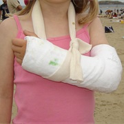 Stookey = Plaster Cast