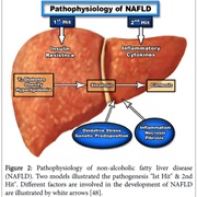 Non-Alcoholic Fatty Liver Disease (NAFLD)