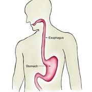 Stomach Cancer