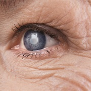 Diabetic Retinopathy