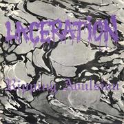 Laceration - Ripping Avulsion