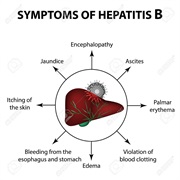 Hepatitis B