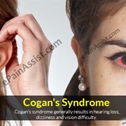 Cogan's Syndrome