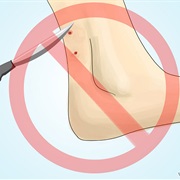 Survive a Poisonous Snake Attack