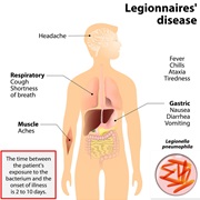 Legionellosis (Legionnaires Disease)