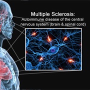 Multiple Sclerosis