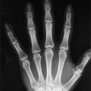 X-Ray Imaging