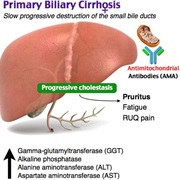 Primary Biliary Cirrhosis