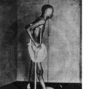 Cause of Beri-Beri Discovered (1901)