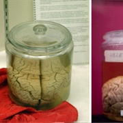 Wilder Brain Collection