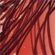 Recloose - Cardiology