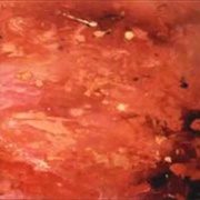 Dificil Equilibrio - Dificil Equilibrio