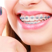 Toothy Braces