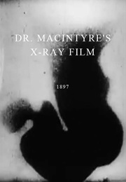 Dr. Macintyre&#39;s X-Ray Film (1896)