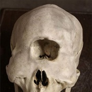 Cyclopia