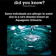 Aquagenic Urticaria