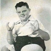 Grady Stiles - Lobster Boy