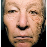 Wear Sunscreen Every Day