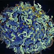 HIV Attacks