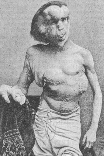 Joseph Merrick: The Real Elephant Man (2005)