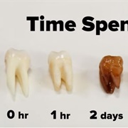 Coca-Cola Dissolves Teeth
