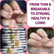 Use Cuticle Oil Every Night
