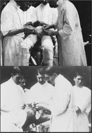 Operación De Quiste Hidatídico De Pulmón (1899)