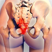 Tailbone Pain Several Days Before Period