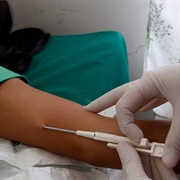 Birth Control Implant