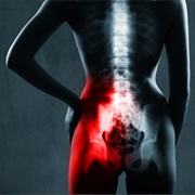Chronic Lower Back/Pelvic/Hip/Leg Pain