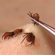 Tick Bite