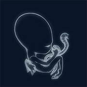 Sigur Ròs- Ný Batteri