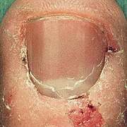 Skrape - New Killer America