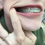 Braces Elastics