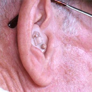 Having Trouble Hearing: 1 in 2 Older Than 75; 1 in 5.5 (20 to 69)